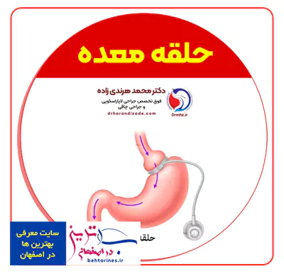 2-best bariatric surgeon in Isfahan-بهترین دکتر فوق تخصص چاقی و لاغری حلقه معده اصفهان