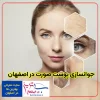 بهترین مرکز لیزر زیبایی اصفهان-کلینیک یکتا