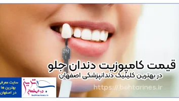 قیمت کامپوزیت دندان جلو در بهترین کلینیک دندانپزشکی اصفهان