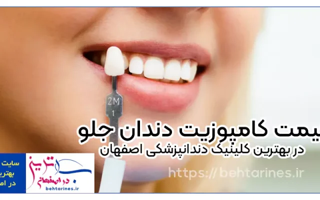 قیمت کامپوزیت دندان جلو در بهترین کلینیک دندانپزشکی اصفهان